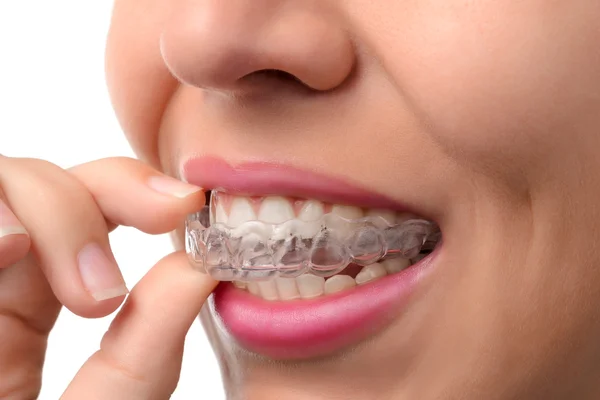 What Would Be Risks Involved Before Visiting An Invisalign Dentist?